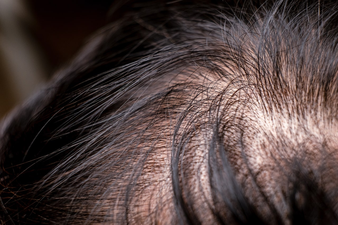 A close-up of a person's scalp showing hair follicles and hair growth.